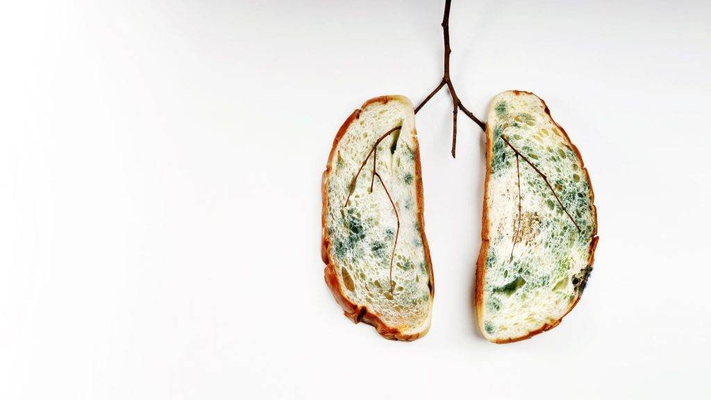 Is Histoplasmosis A Yeast Or Mold Infection? - Overcoming Candida