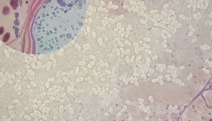 A detailed overview of a Candida biofilm, showcasing clusters of yeast cells forming a dense, protective layer. In the foreground, magnified sections reveal the intricate texture of the biofilm, with shades of white and cream, interspersed with hints of yellow. The middle ground features a vibrant, microscopic view of the yeast cells, surrounded by a backdrop of human tissue, depicting a natural, organic environment. The lighting is soft and diffuse, mimicking natural illumination to enhance the biological details, with a slight focus blur to emphasize the biofilm structure in the foreground. The atmosphere is clinical yet informative, inviting a sense of curiosity and understanding about Candida biofilm phenotypes and their implications in health.