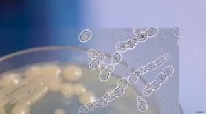 A highly detailed microscopic view of Candida parapsilosis, showcasing its unique cellular structure and characteristics. In the foreground, focus on the yeast cells, displaying their round, budding forms with a slight sheen, surrounded by a faint halo of light that highlights their contours. In the middle ground, include a blurred view of a nutrient agar plate, subtly indicating the growth pattern of the colonies, showcasing the characteristic morphology. In the background, incorporate a soft-focus gradient that transitions from deep blue to light lavender, creating a serene laboratory atmosphere. The lighting should be bright and natural, emphasizing the clarity of the microscopic details. Capture a scientific, educational mood, conveying the importance of Candida parapsilosis in microbiology.