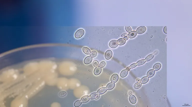 A highly detailed microscopic view of Candida parapsilosis, showcasing its unique cellular structure and characteristics. In the foreground, focus on the yeast cells, displaying their round, budding forms with a slight sheen, surrounded by a faint halo of light that highlights their contours. In the middle ground, include a blurred view of a nutrient agar plate, subtly indicating the growth pattern of the colonies, showcasing the characteristic morphology. In the background, incorporate a soft-focus gradient that transitions from deep blue to light lavender, creating a serene laboratory atmosphere. The lighting should be bright and natural, emphasizing the clarity of the microscopic details. Capture a scientific, educational mood, conveying the importance of Candida parapsilosis in microbiology.