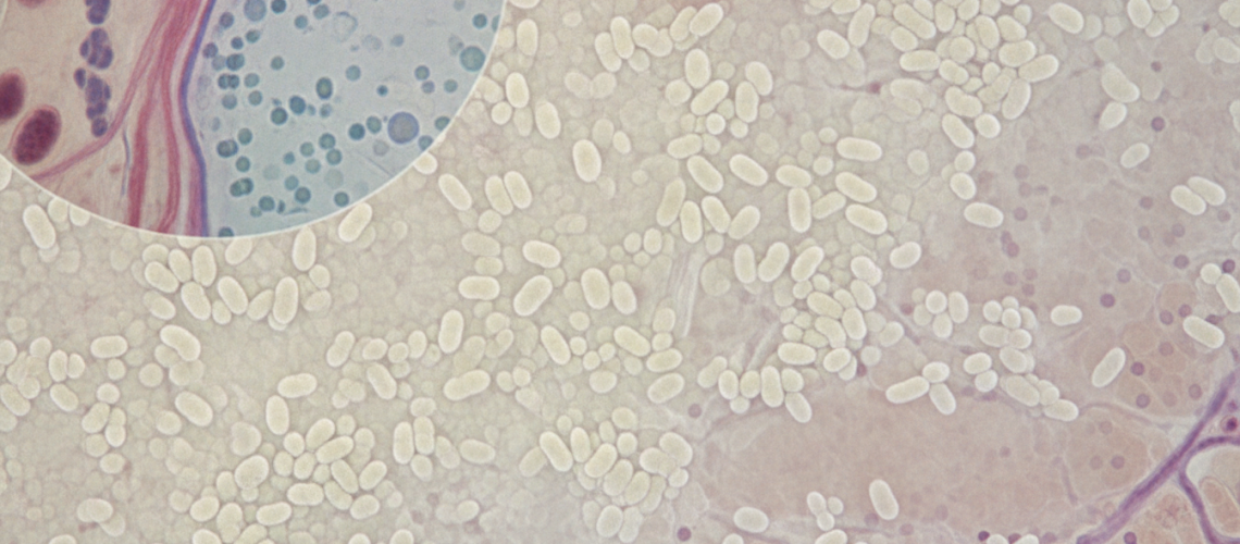A detailed overview of a Candida biofilm, showcasing clusters of yeast cells forming a dense, protective layer. In the foreground, magnified sections reveal the intricate texture of the biofilm, with shades of white and cream, interspersed with hints of yellow. The middle ground features a vibrant, microscopic view of the yeast cells, surrounded by a backdrop of human tissue, depicting a natural, organic environment. The lighting is soft and diffuse, mimicking natural illumination to enhance the biological details, with a slight focus blur to emphasize the biofilm structure in the foreground. The atmosphere is clinical yet informative, inviting a sense of curiosity and understanding about Candida biofilm phenotypes and their implications in health.