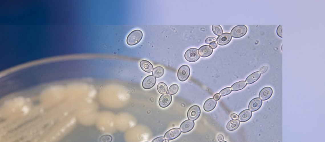 A highly detailed microscopic view of Candida parapsilosis, showcasing its unique cellular structure and characteristics. In the foreground, focus on the yeast cells, displaying their round, budding forms with a slight sheen, surrounded by a faint halo of light that highlights their contours. In the middle ground, include a blurred view of a nutrient agar plate, subtly indicating the growth pattern of the colonies, showcasing the characteristic morphology. In the background, incorporate a soft-focus gradient that transitions from deep blue to light lavender, creating a serene laboratory atmosphere. The lighting should be bright and natural, emphasizing the clarity of the microscopic details. Capture a scientific, educational mood, conveying the importance of Candida parapsilosis in microbiology.