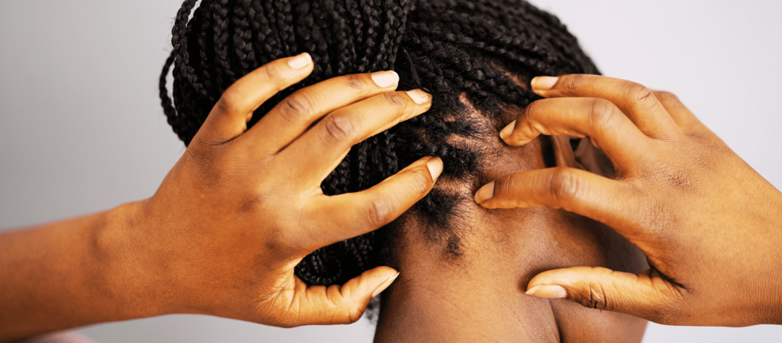 itchy_scalp